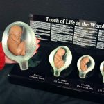 placenta1