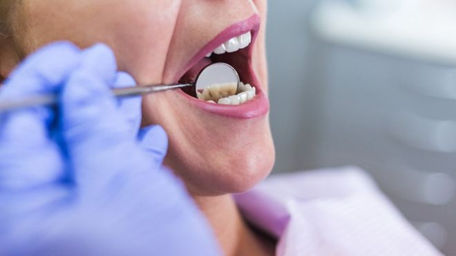 Periodontitis – Important Thing To Know