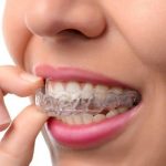 bruxism treatment