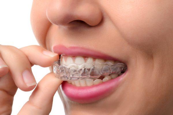 bruxism treatment