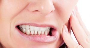 bruxism treatment