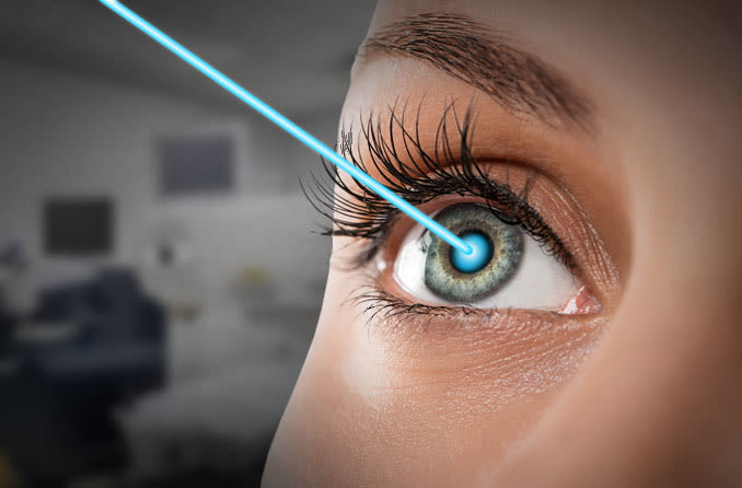 Laser Eye Surgery