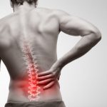 How to Treat Low Back Pain Effectively