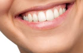 price of veneers