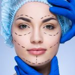 Threadlift Singapore