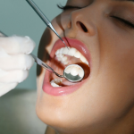 Is It Possible to Avoid Lost Dental Filling?