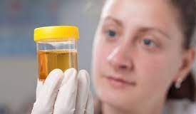 Synthetic urine